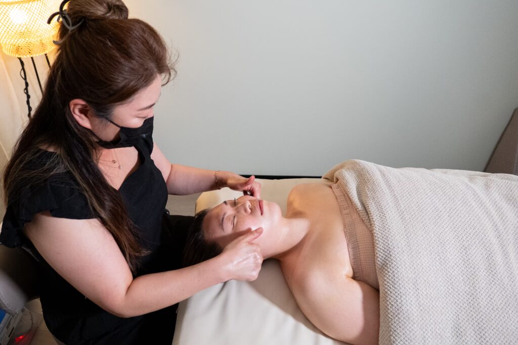 Practitioner performing acupuncture at a North Shore wellness clinic